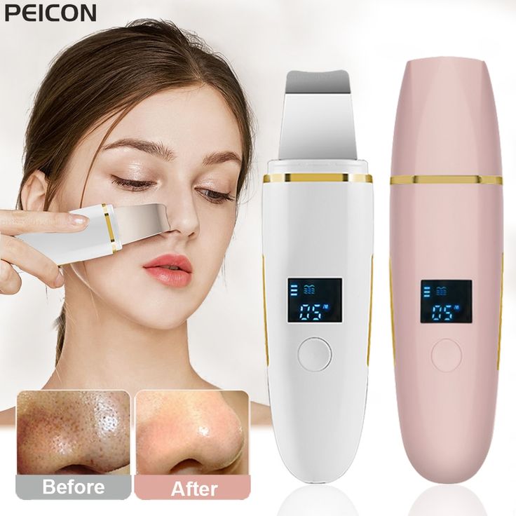 Ultrasonic Skin Scrubber
